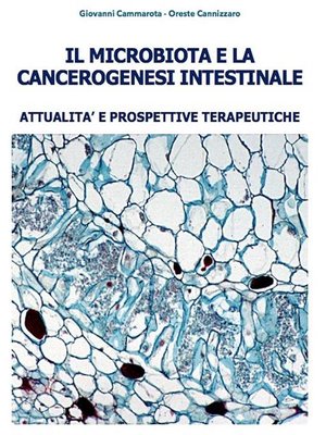 cover image of Microbiota e Cancerogenesi Intestinale